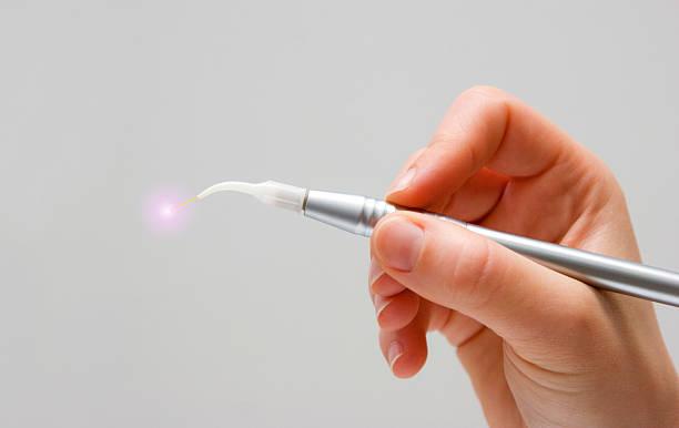 Unlocking Precision: The Era of Laser-Assisted Root Canals in Modern Dentistry